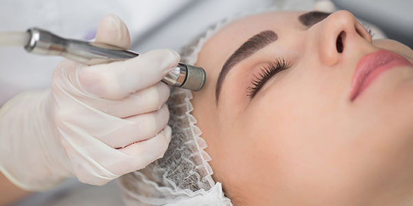 Microdermabrasion exfoliation